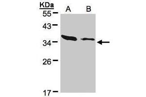 Western Blotting (WB) image for anti-Actin Related Protein 2/3 Complex, Subunit 2, 34kDa (ARPC2) antibody (ABIN2855249)