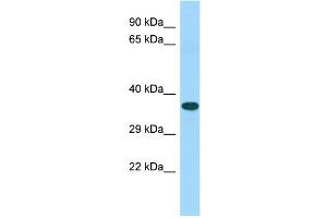 Host: Rabbit Target Name: C15orf52 Sample Type: Fetal Heart lysates Antibody Dilution: 1. (C15ORF52 抗体  (C-Term))