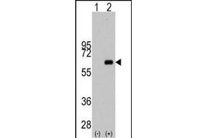 Western blot analysis of MYC (arrow) using rabbit polyclonal MYC Antibody  (ABIN388720 and ABIN2838829). (c-MYC 抗体  (AA 351-380))