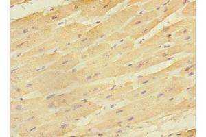 Immunohistochemistry of paraffin-embedded human heart tissue using ABIN7151514 at dilution of 1:100 (EAF2 抗体  (AA 1-170))