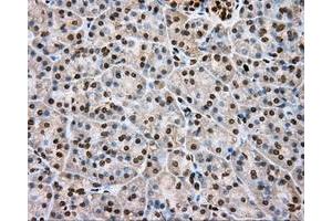 Immunohistochemical staining of paraffin-embedded lung tissue using anti-DAPK2 mouse monoclonal antibody. (DAPK2 抗体)