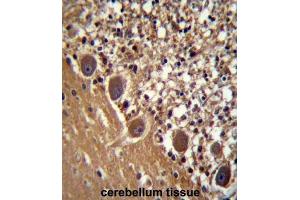 Immunohistochemistry (IHC) image for anti-Phenylalanyl-tRNA Synthetase, beta Subunit (FARSB) antibody (ABIN2997725) (FARSB 抗体)