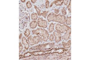 Immunohistochemical analysis of ABIN6242882 on paraffin-embedded Human kidney tissue. (VDAC2 抗体  (N-Term))