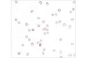 Immunocytochemistry of SCUBE2 in Daudi cells with SCUBE2 antibody at 20 μg/ml. (SCUBE2 抗体  (Center))