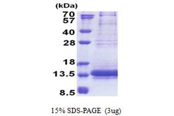 NDUFV3 Protein (AA 35-108) (His tag)