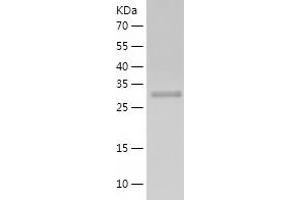 DFFA Protein (AA 1-331) (His tag)