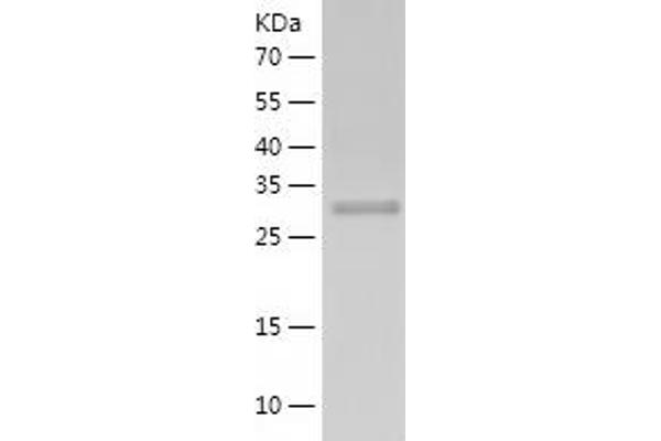 DFFA Protein (AA 1-331) (His tag)