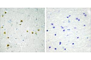 Peptide - +Immunohistochemistry analysis of paraffin-embedded human brain tissue using DNA Ligase 4 antibody. (LIG4 抗体  (Internal Region))