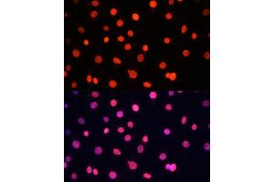Immunofluorescence analysis of C6 cells using SOX2 Polyclonal Antibody (ABIN6130648, ABIN6148295, ABIN6148297 and ABIN6215241) at dilution of 1:100 (40x lens). (SOX2 抗体  (AA 1-140))