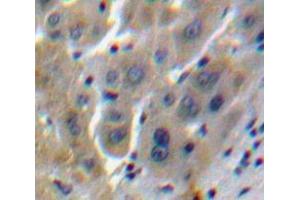 Used in DAB staining on fromalin fixed paraffin-embedded Liver tissue (CCL16 抗体  (AA 20-120))