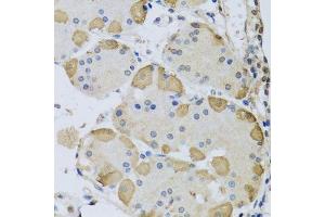 Immunohistochemistry of paraffin-embedded human stomach using ANAPC10 antibody. (ANAPC10 抗体  (AA 1-185))