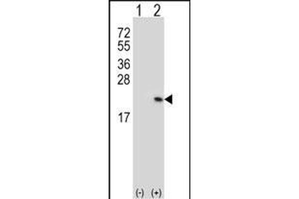 Riboflavin Kinase 抗体  (N-Term)