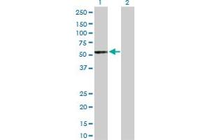 Western Blot analysis of UGT2B15 expression in transfected 293T cell line by UGT2B15 MaxPab polyclonal antibody. (UGT2B15 抗体  (AA 1-530))