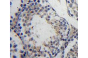 Used in DAB staining on fromalin fixed paraffin-embedded testis tissue (Ubiquitin Hydrolase L3 (AA 2-230) 抗体)