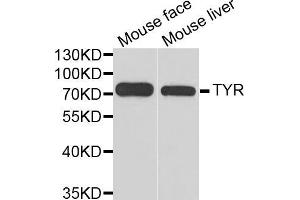 Western blot analysis of extracts of various cell lines, using TYR antibody (ABIN5970593) at 1/1000 dilution. (TYR 抗体)