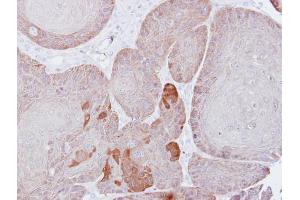 IHC-P Image Immunohistochemical analysis of paraffin-embedded Cal27 xenograft, using Proteasome 26S S3, antibody at 1:500 dilution. (Proteasome 26S S3 (Center) 抗体)