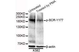 Western blot analysis of extracts of K-562 cells, using Phospho-BCR-Y177 antibody (ABIN5995631) at 1/1000 dilution. (BCR 抗体  (pTyr177))