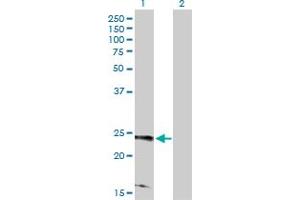 Western Blot analysis of RRAS2 expression in transfected 293T cell line by RRAS2 MaxPab polyclonal antibody. (RRAS2 抗体  (AA 1-204))