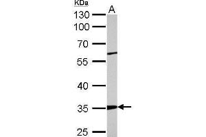 Western Blotting (WB) image for anti-Actin Related Protein 2/3 Complex, Subunit 2, 34kDa (ARPC2) antibody (ABIN2855249)