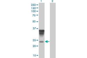 Western Blotting (WB) image for anti-Orosomucoid 1 (ORM1) (AA 18-201) antibody (ABIN562078)