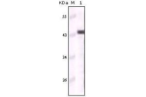 Western Blot showing CK5 antibody used against truncated CK5 recombinant protein (Cytokeratin 5 抗体)