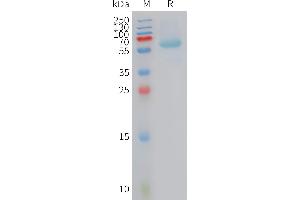 Human BAMBI Protein, hFc Tag on SDS-PAGE under reducing condition. (BAMBI Protein (AA 27-152) (Fc Tag))