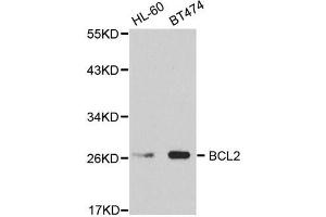 Western Blotting (WB) image for anti-B-Cell CLL/lymphoma 2 (BCL2) antibody (ABIN1876758) (Bcl-2 抗体)