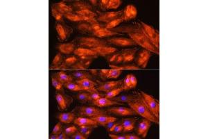 Immunofluorescence analysis of H9C2 cells using ZCCHC11 Rabbit pAb (ABIN6128939, ABIN6150406, ABIN6150407 and ABIN6221650) at dilution of 1:100. (ZCCHC11 抗体  (AA 1-290))