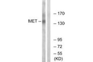 Western blot analysis of extracts from HepG2 cells, using Met (Ab-1349) Antibody. (c-MET 抗体  (AA 1316-1365))