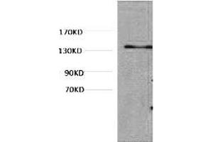 Western blot analysis of Hela, diluted at 1:1000. (COL3 抗体)