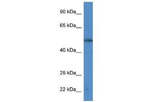 WB Suggested Anti-CAMK4 Antibody Titration: 1. (CAMK4 抗体  (C-Term))
