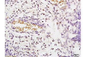 Formalin-fixed and paraffin embedded rat kidney labeled with Anti STK3/MST3 Polyclonal Antibody, Unconjugated (ABIN872978) at 1:200 followed by conjugation to the secondary antibody and DAB staining (STK3,STK4 (AA 101-200) 抗体)