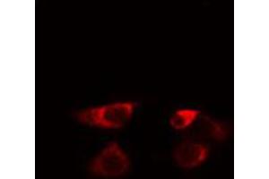 ABIN6274576 staining HeLa cells by IF/ICC. (Serotonin Receptor 5A 抗体  (Internal Region))