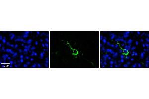 Rabbit Anti-LPIN1 Antibody  Catalog Number: ARP53826_P050  Formalin Fixed Paraffin Embedded Tissue: Human Pineal Tissue  Observed Staining: Cytoplasmic and membrane in cell bodies and processes of pinealocytes  Primary Antibody Concentration: 1:100  Other Working Concentrations: 1/600  Secondary Antibody: Donkey anti-Rabbit-Cy3  Secondary Antibody Concentration: 1:200  Magnification: 20X  Exposure Time: 0. (Lipin 1 抗体  (N-Term))
