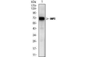 Western blot analysis using MMP2 mouse mAb against A431 (1) cell lysate. (MMP2 抗体  (AA 242-396))
