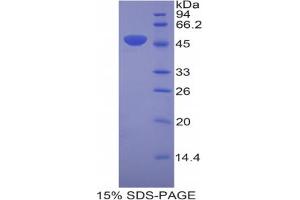 SDS-PAGE analysis of Mouse Laminin gamma 2 Protein. (LAMC2 蛋白)