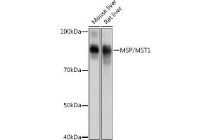 Western blot analysis of extracts of various cell lines, using MSP/MST1 Rabbit mAb (ABIN1680891, ABIN1680890, ABIN3015057 and ABIN3015058) at 1:1000 dilution. (MST1 抗体)