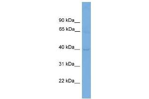 Human ACHN; WB Suggested Anti-CNTD1 Antibody Titration: 0. (CNTD1 抗体  (N-Term))