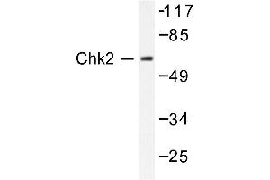 Image no. 1 for anti-Checkpoint Kinase 2 (CHEK2) antibody (ABIN271879) (CHEK2 抗体)