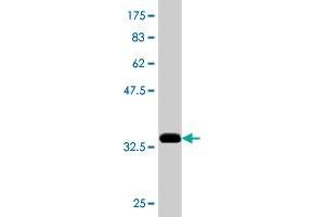 Western Blotting (WB) image for anti-Cerebellar Degeneration-Related Protein 2, 62kDa (CDR2) (AA 296-404) antibody (ABIN560316)