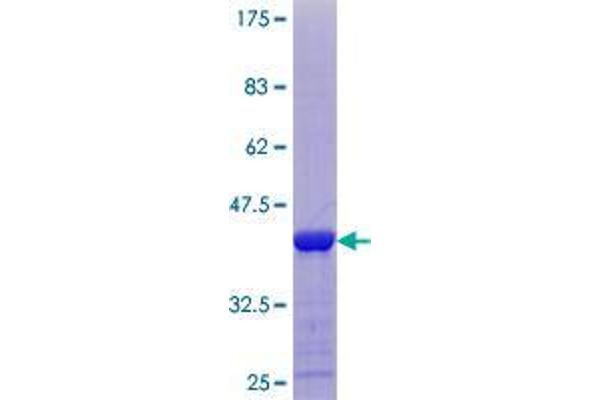 CARD17 Protein (AA 1-110) (GST tag)