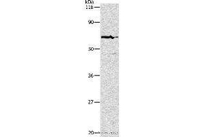 Western blot analysis of Hela cell, using PKM2 Polyclonal Antibody at dilution of 1:500 (PKM 抗体)