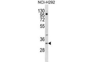 Western Blotting (WB) image for anti-Triggering Receptor Expressed On Myeloid Cells-Like 1 (TREML1) antibody (ABIN3000417) (TREML1 抗体)