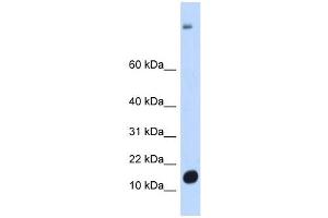 C6ORF201 antibody used at 1 ug/ml to detect target protein. (C6orf201 抗体  (N-Term))