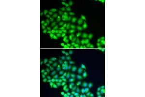 Immunofluorescence analysis of HeLa cells using ERCC2 antibody (ABIN5973287). (ERCC2 抗体)