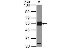 WB Image Sample (30 ug of whole cell lysate) A: JurKat 10% SDS PAGE CD2 antibody antibody diluted at 1:1000 (CD2 抗体  (C-Term))