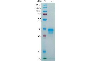 FOLR1 Protein (AA 25-234) (His tag)