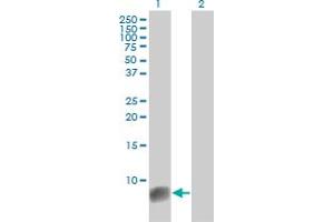 Western Blotting (WB) image for anti-S100 Calcium Binding Protein A6 (S100A6) (AA 1-90) antibody (ABIN562771)