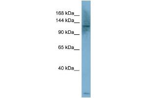WB Suggested Anti-PLCB1  Antibody Titration: 0. (Phospholipase C beta 1 抗体  (Middle Region))