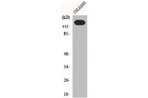 Western Blot analysis of C0L0205 cells using N-cadherin Polyclonal Antibody (N-Cadherin 抗体  (C-Term))